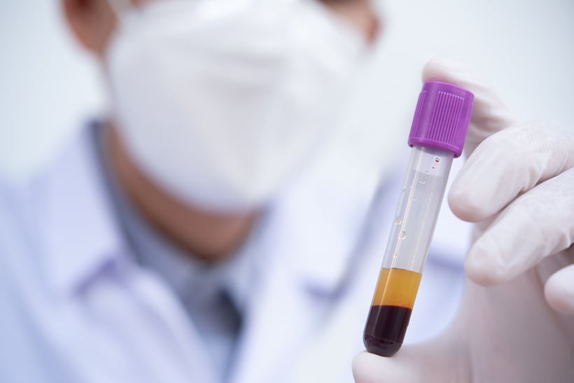 A masked scientist hold a vile of blood and plasma