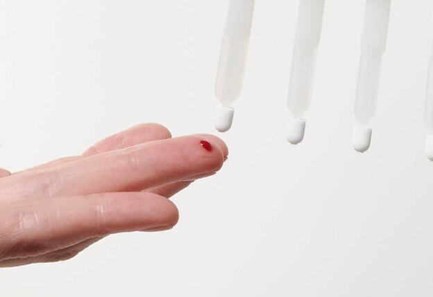 Fingertip Sampling Remote DBS Offers a Solution to Metabolite Stabilization