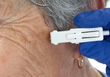 Harpera Device Skin Sampling