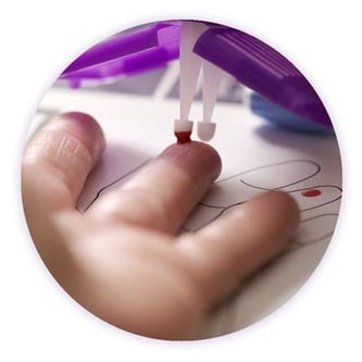 Detailfoto eines Bluttropfens aus einem Finger, der von der Spitze des Mitra-Microsamplers aufgenommen wird.