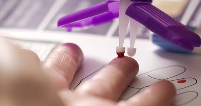 microsampling-upclose