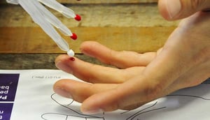Close up of someone taking a blood micro sample from their finger with a mitra tip while at home