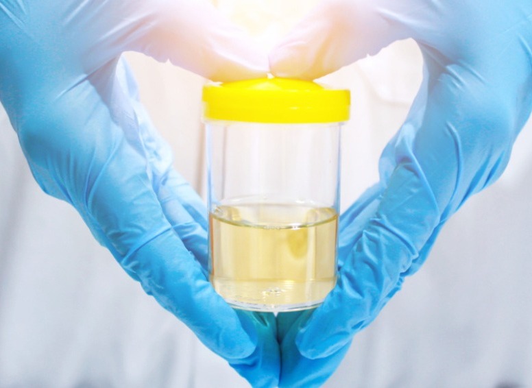 Microsampling Blog | Neoteryx