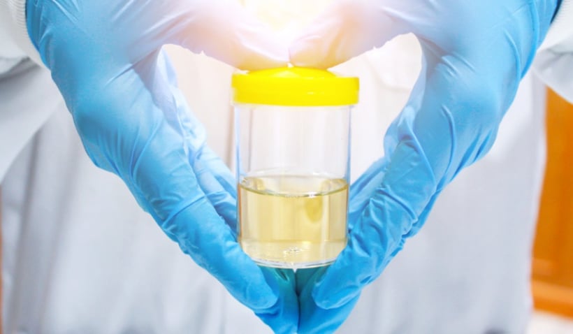 a close up photo of a laboratory container with urine.