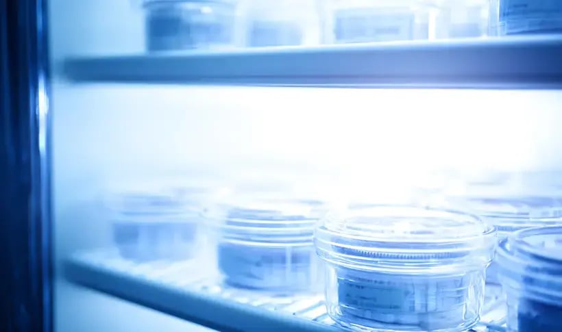 a photo of various tissue samples stored in a freezer unit within a laboratory.