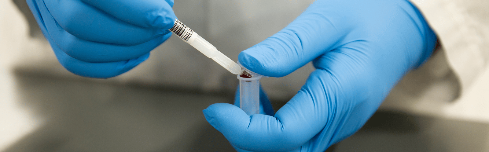 dried-blood-sample-laboratory