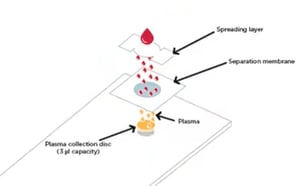 dried-palsma-spot-schematic