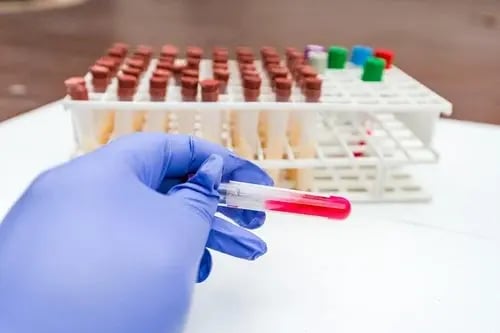 a gloved hand hold a vile of blood in a laboratory setting