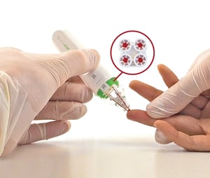 a gloved hand takes a blood drop sample from a finger.