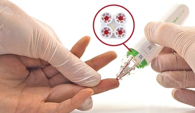hemaPEN finger-stick blood sample collection