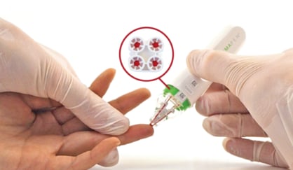 the hemapen dbs device takes a capillary blood sample from a pricked finger