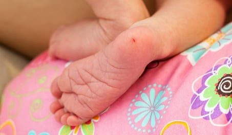 newborn heel-stick blood sampling, iStock-610035786-1