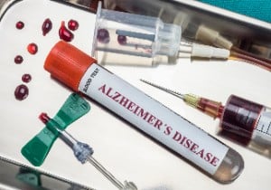 blood-test-for-alzheimers-disease