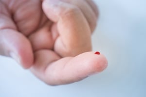 A single drop of blood on the index finger, finger prick capillary blood collection