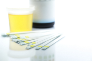 a urine sample is placed next to drug testing paper strips.