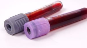 mobile phlebotomy vials from venipuncture filled with blood