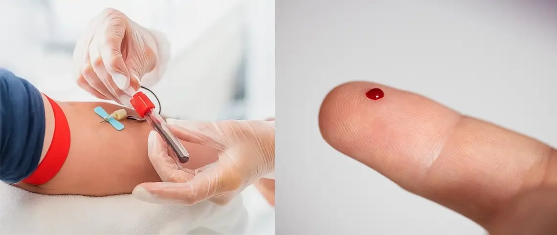 A side-by-side comparison of blood volume differences between venipuncture and capillary blood samples via a finger stick.