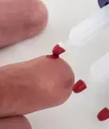 close up of a volumetric absorptive microsampling device collecting a capillary blood sample from a finger tip.