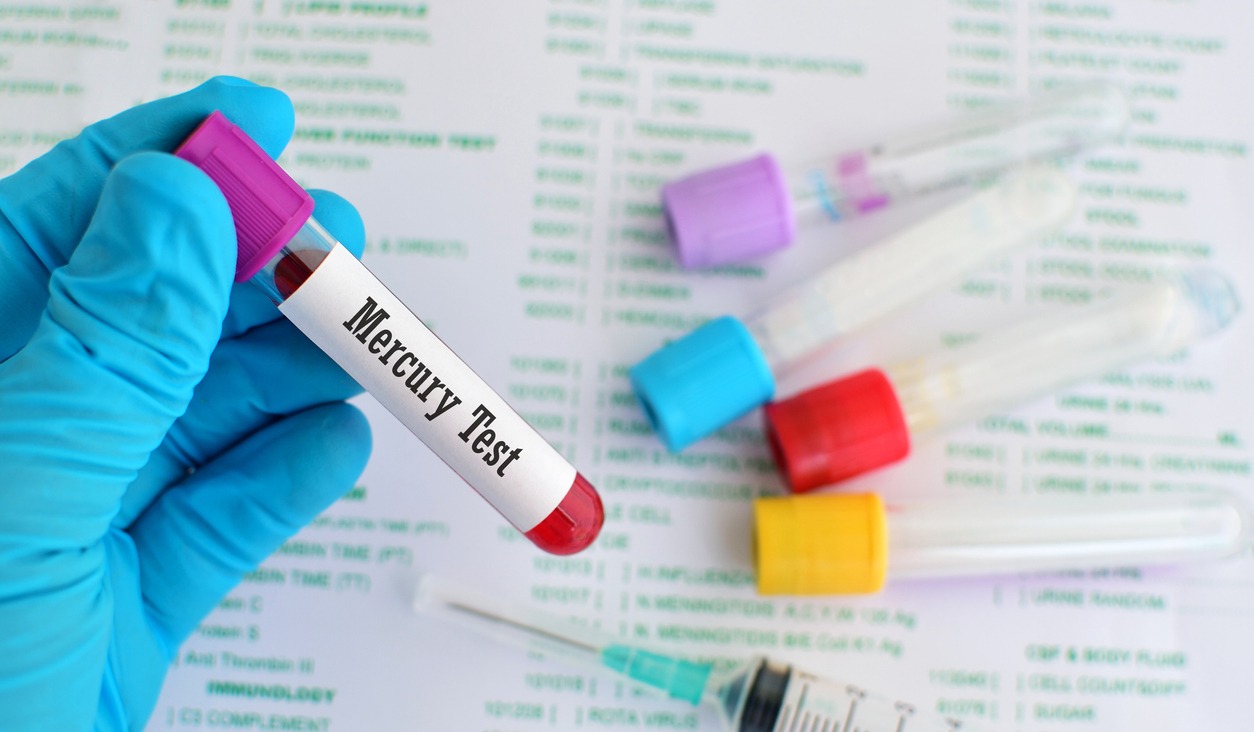 Biomonitoring Mercury exposure in blood samples