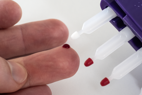 about-to-collect-capillary-blood-micro-sample