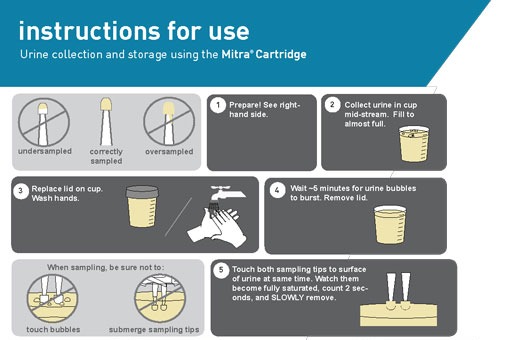 Dried urine samples on Mitra devices with VAMS