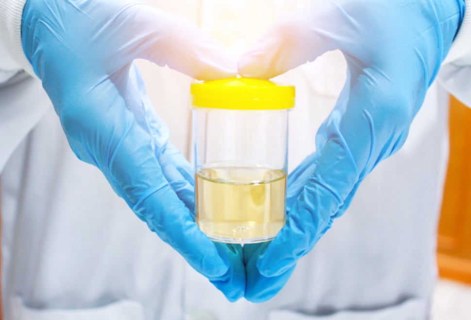 urine collection for urinalysis