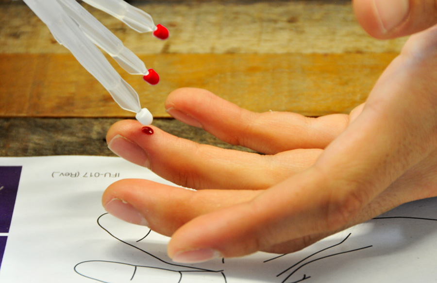 blood drops are collected of a finger with a mitra blood collection device.