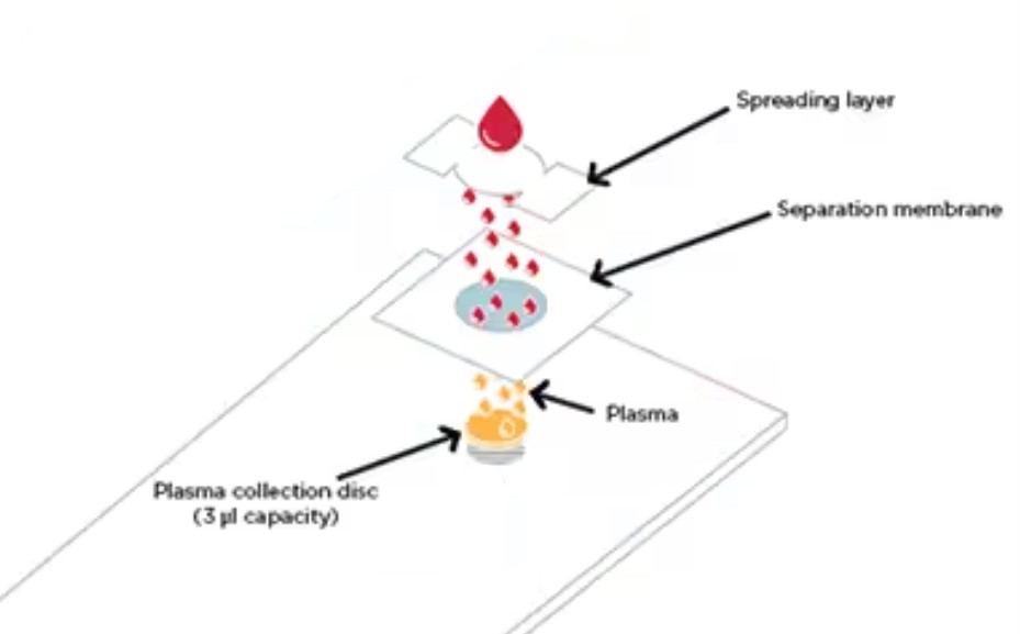 dried-palsma-spot-schematic