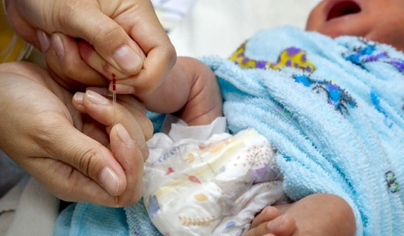 heel prick procedure for newborn blood spot screening