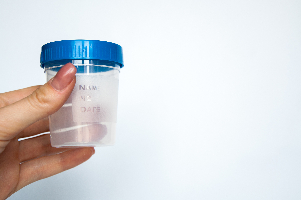 Dried urine sampling is an alternative to traditional liquid urine sampling