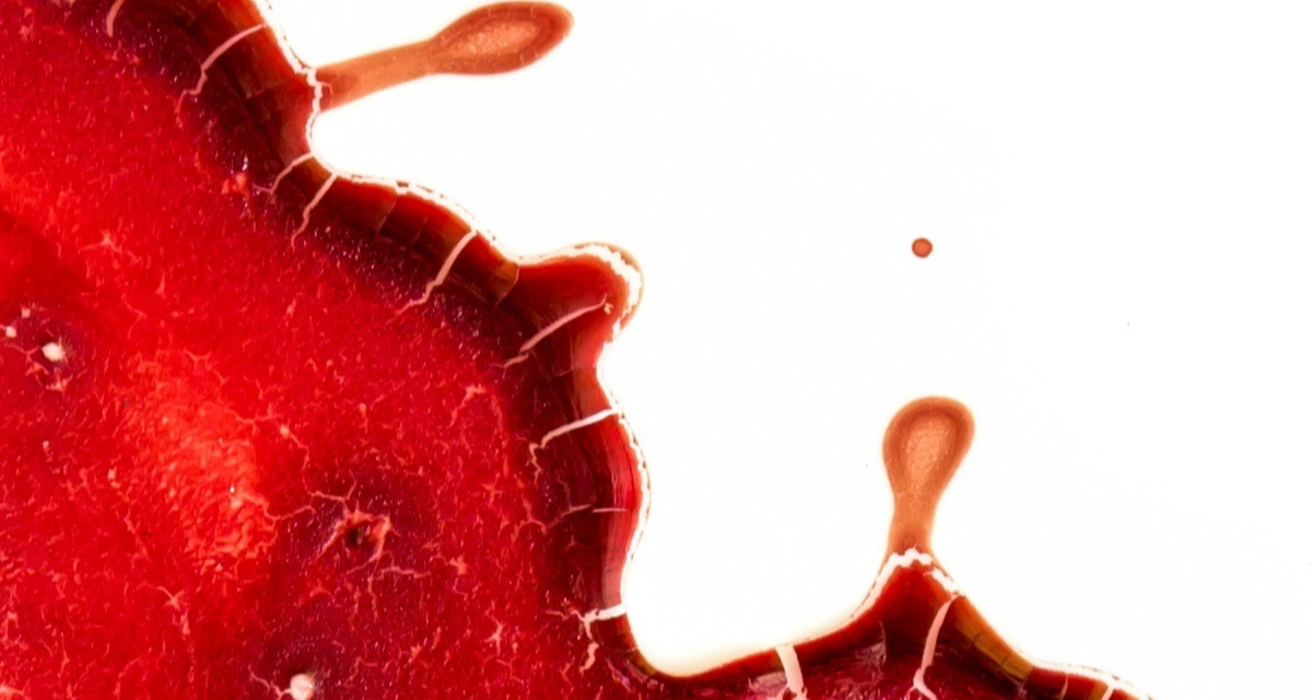 dried blood tests using a drop of blood can replace many wet blood tests