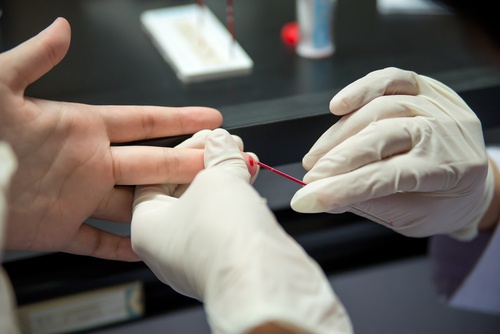 finger-prick-capillary-blood-collection-white-gloves-taking-blood-sampling-from-patient