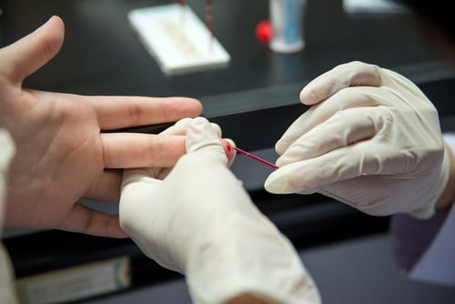 capillary blood collection: advantages and disadvantages
