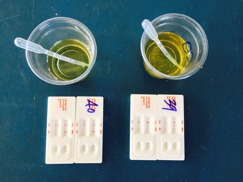 Urine Sampling in Sports Drug Testing