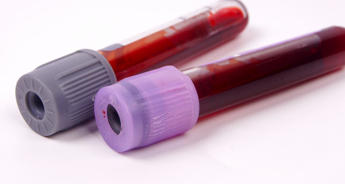 Mobile phlebotomy vs. patient-managed blood collection
