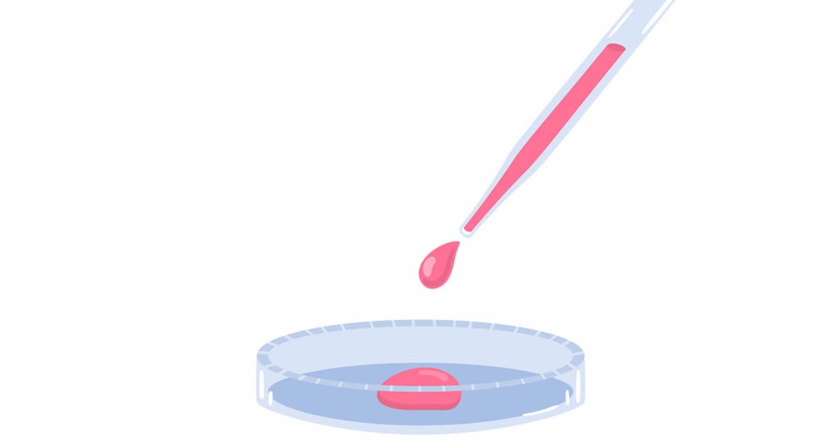 remote-specimen-collection-using-drop-of-blood-on-petri-dish